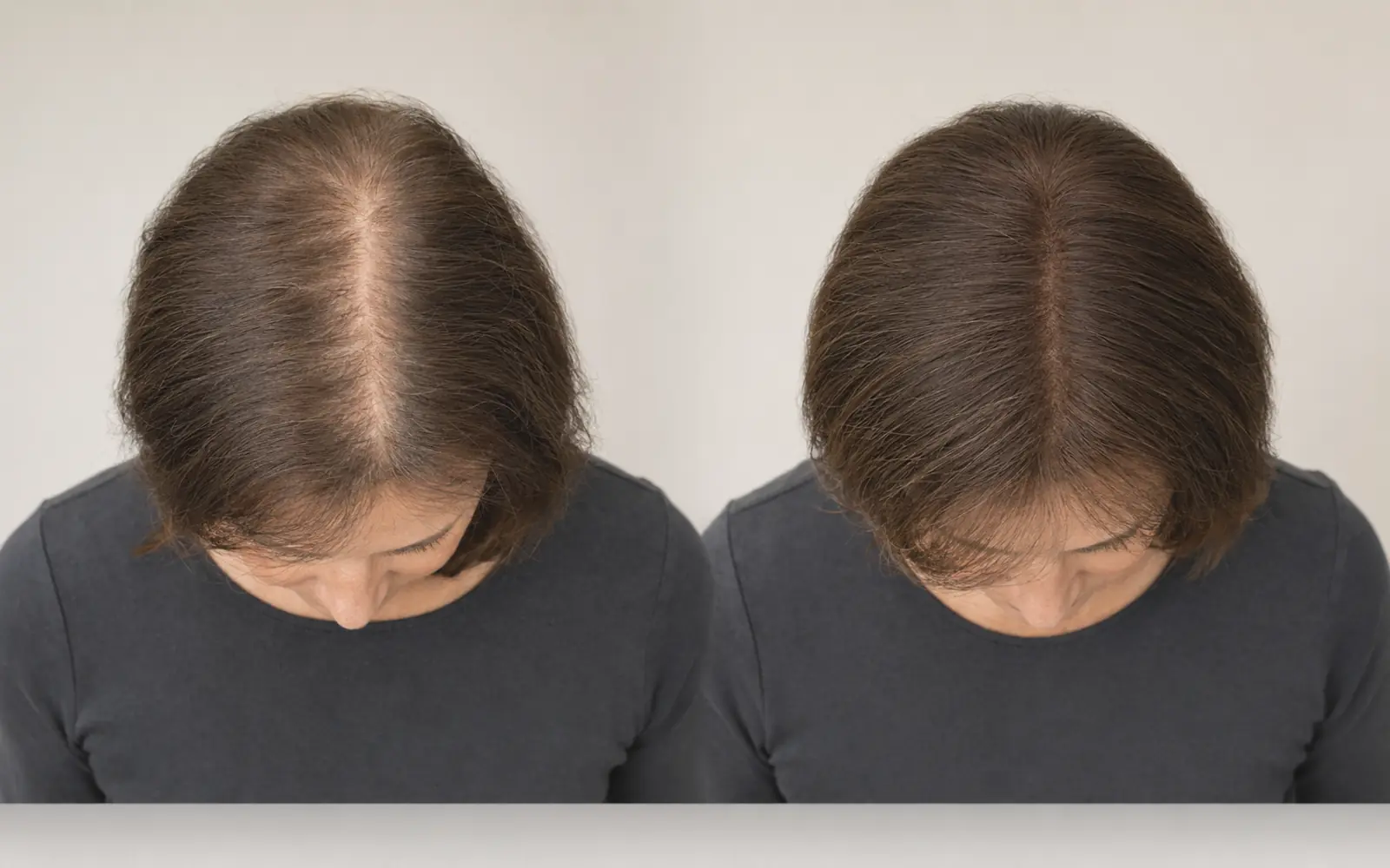 LEV silk top hair topper before-and-after comparison showing natural crown coverage and restored volume